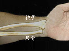 2~3天后做肩,肘关节主动运动,手指屈伸,对指,对掌主动练习