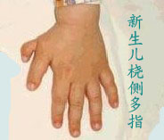 ָӰ캢ӷ