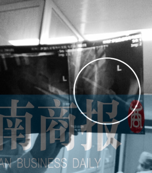 һ20