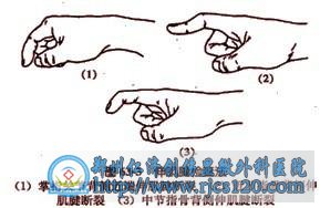 쾱ָ