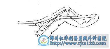 쾱ָ
