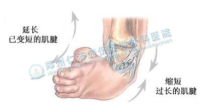 ڷǮ