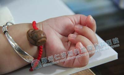 治好束带综合征 <wbr>妈妈不用再担心