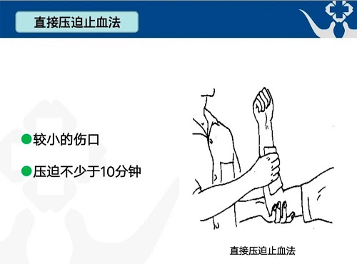 止血法,加压包扎止血法,填塞止血法,止血带止血法和指压动脉止血法
